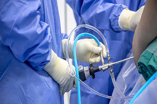 Knee Arthroscopy