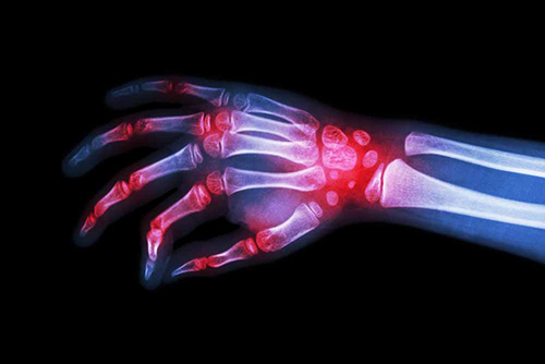 Rheumatology