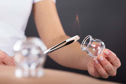 Thérapie par ventouses - Hijama