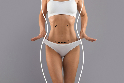 Liposuction (fat removal)