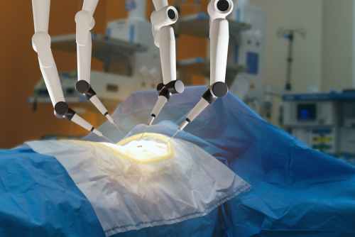 Robotic Surgery for Heart