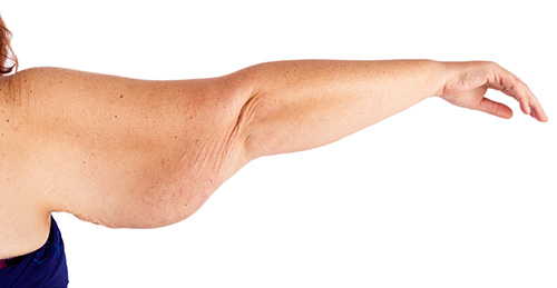 Which Doctor Performs Arm Lifts?