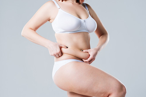 After the Tummy Tuck Abdominoplasty