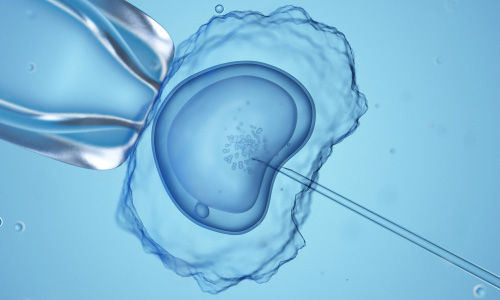 IVF Tüp Bebek Tedavisi Nasıl Gerçekleştirilir?