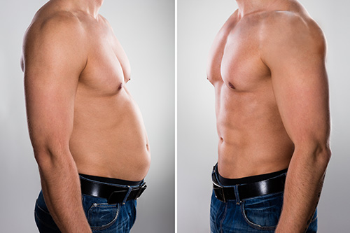 Natural Six Pack Looks With Six Pack Surgery