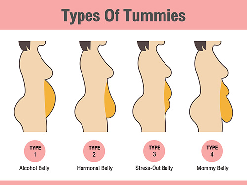 What is Tummy Tuck Abdominoplasty?
