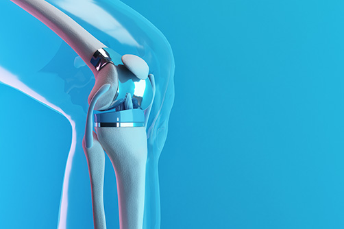 ما هو نوع مفصل الركبة الاصطناعي المستخدم؟