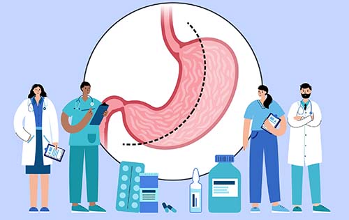 Y a-t-il une limite d'âge pour la chirurgie de la gastrectomie en manchon ?